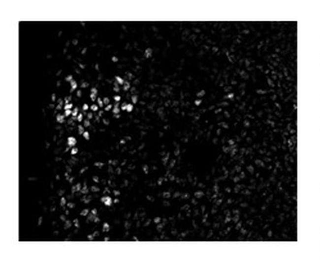 ZEB2 Antibody in Immunohistochemistry (IHC)