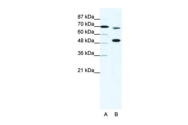 MLL4 Antibody in Western Blot (WB)