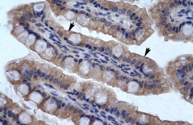 SMPDL3B Antibody in Immunohistochemistry (IHC)