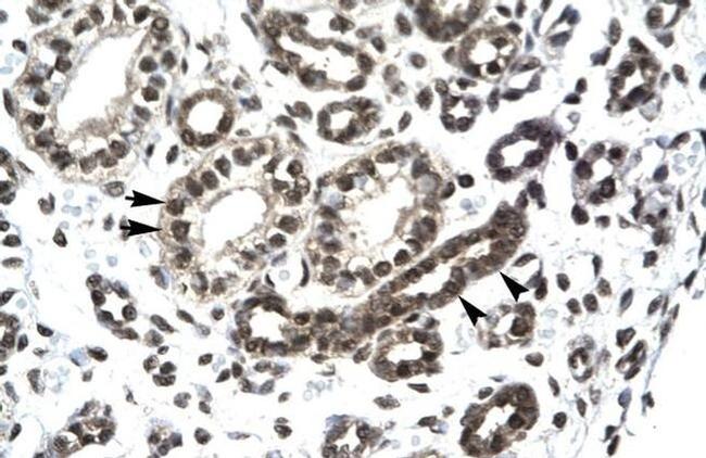 PTHLH Antibody in Immunohistochemistry (Paraffin) (IHC (P))