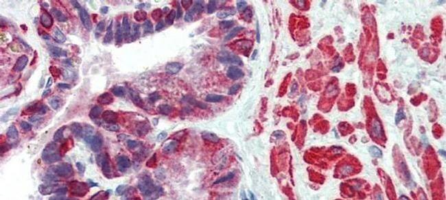 KIF13B Antibody in Immunohistochemistry (Paraffin) (IHC (P))