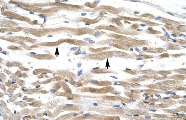 KIFC2 Antibody in Immunohistochemistry (IHC)