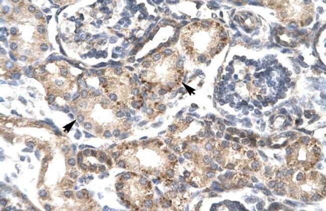 RGS20 Antibody in Immunohistochemistry (IHC)