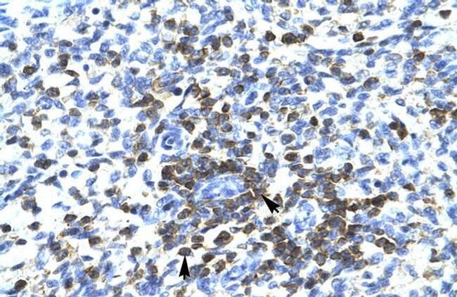 RCOR3 Antibody in Immunohistochemistry (IHC)