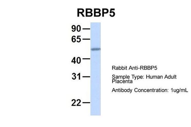 RBBP5 Antibody in Western Blot (WB)