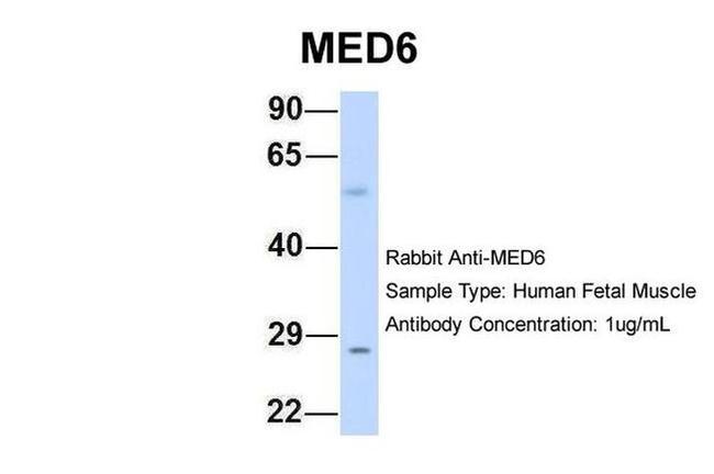 MED6 Antibody in Western Blot (WB)