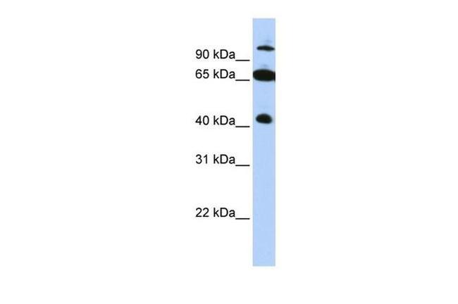 TRIM9 Antibody in Western Blot (WB)