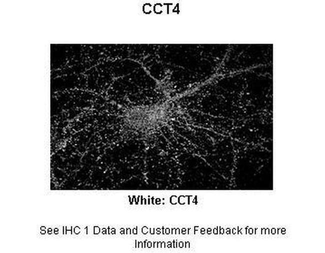 TCP-1 delta Antibody in Immunohistochemistry (Paraffin) (IHC (P))