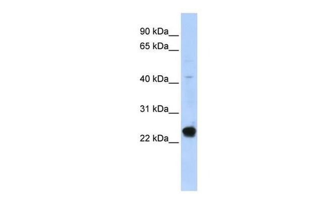 GTL3 Antibody in Western Blot (WB)