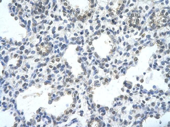 RASSF7 Antibody in Immunohistochemistry (Paraffin) (IHC (P))