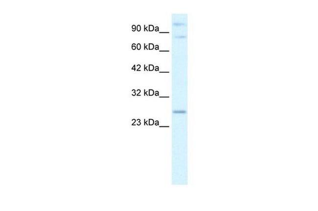 RNF3 Antibody in Western Blot (WB)