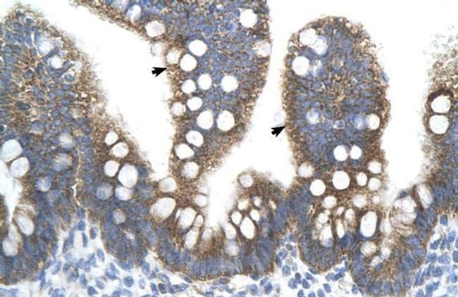 TFB2M Antibody in Immunohistochemistry (IHC)