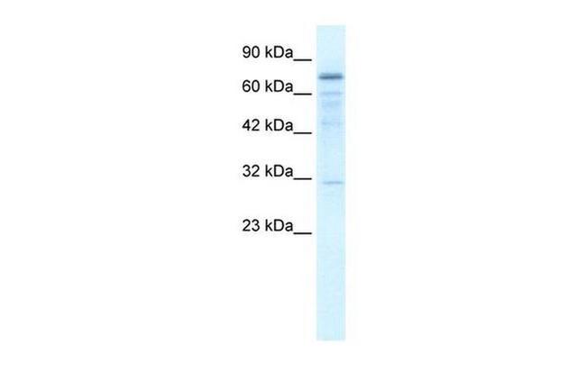 TRMT1 Antibody in Western Blot (WB)