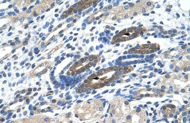 NACC2 Antibody in Immunohistochemistry (IHC)