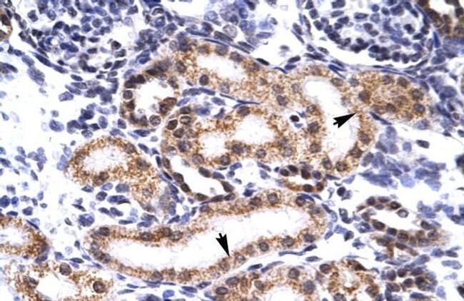 BERP Antibody in Immunohistochemistry (IHC)