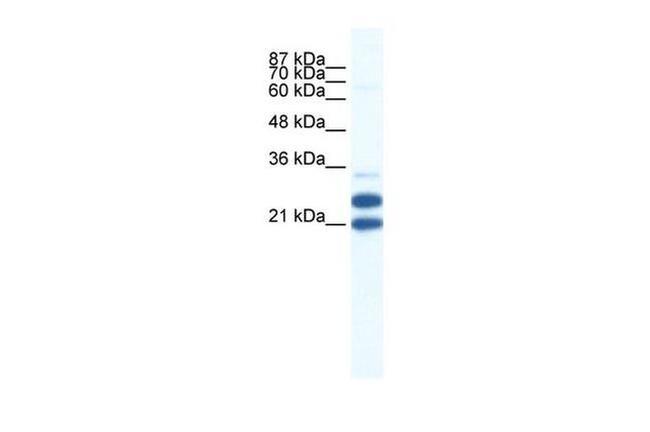 TRIM34 Antibody in Western Blot (WB)