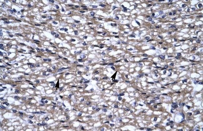 UHRF2 Antibody in Immunohistochemistry (IHC)