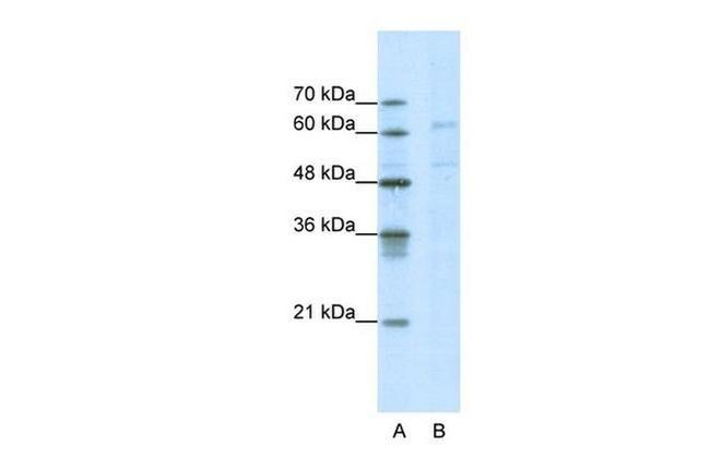 CACNB3 Antibody in Western Blot (WB)