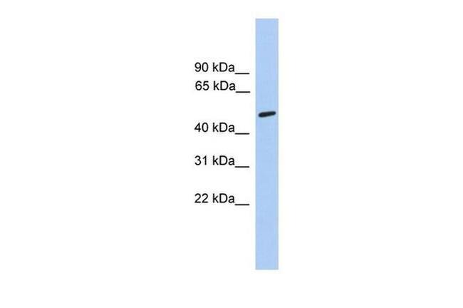 CHRNA5 Antibody in Western Blot (WB)