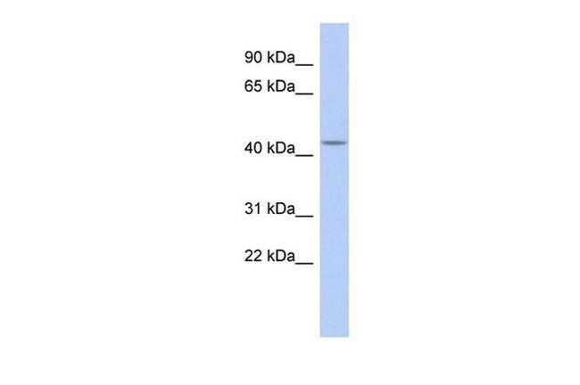 GABRB1 Antibody in Western Blot (WB)