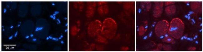 NMDAR2C Antibody in Immunohistochemistry (Paraffin) (IHC (P))