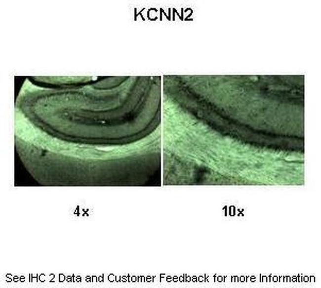 KCNN2 Antibody in Immunohistochemistry (IHC)