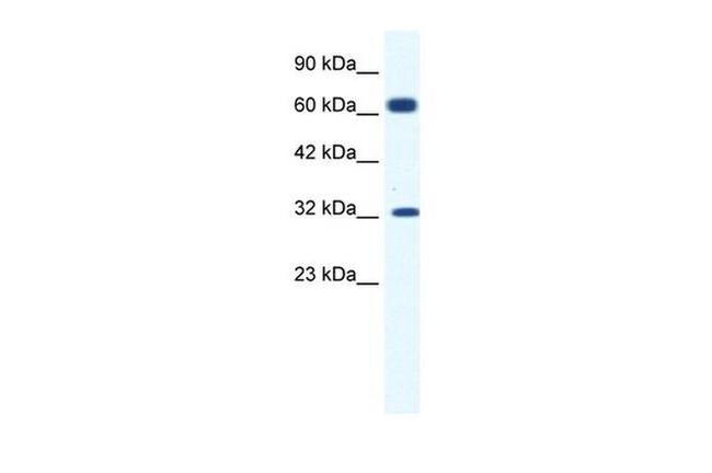 KCNN1 Antibody in Western Blot (WB)