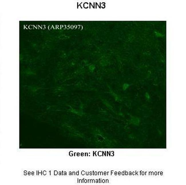 KCNN3 Antibody in Immunohistochemistry (Paraffin) (IHC (P))