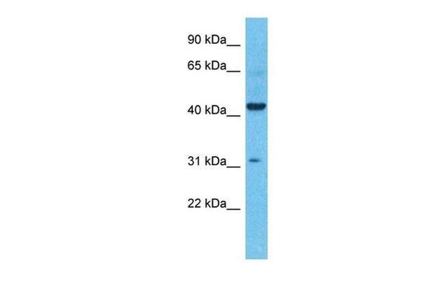 KCNK4 Antibody in Western Blot (WB)