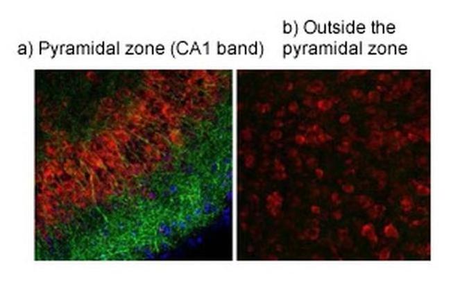 TRPV4 Antibody in Immunohistochemistry (IHC)