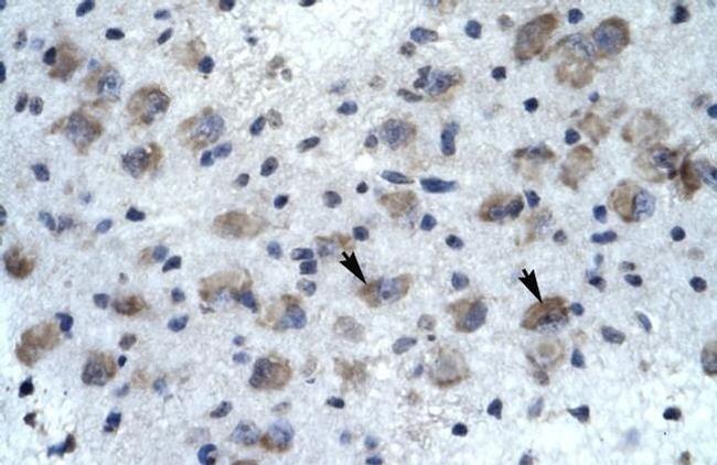 KCNH5 Antibody in Immunohistochemistry (IHC)