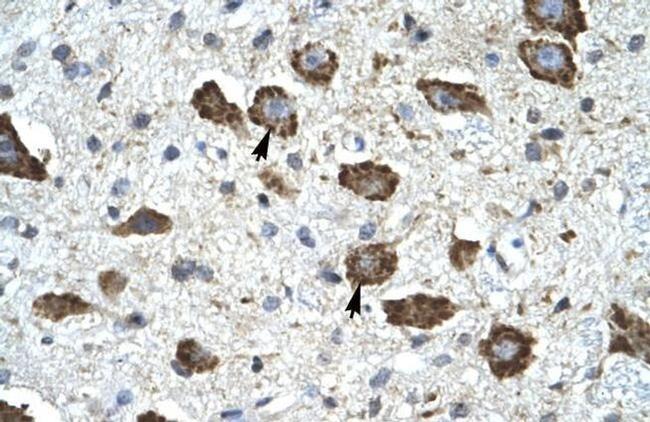 KChIP2 Antibody in Immunohistochemistry (IHC)