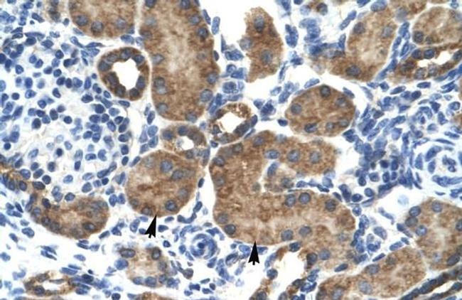 GluR6 Antibody in Immunohistochemistry (IHC)