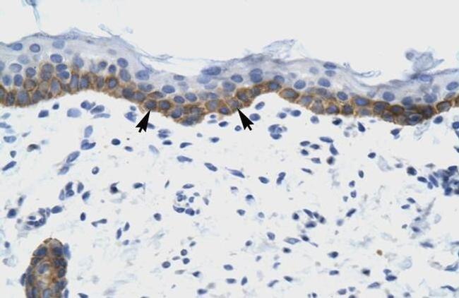 NUDT9 Antibody in Immunohistochemistry (IHC)