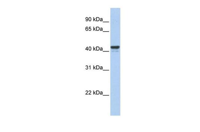 FOXJ1 Antibody in Western Blot (WB)