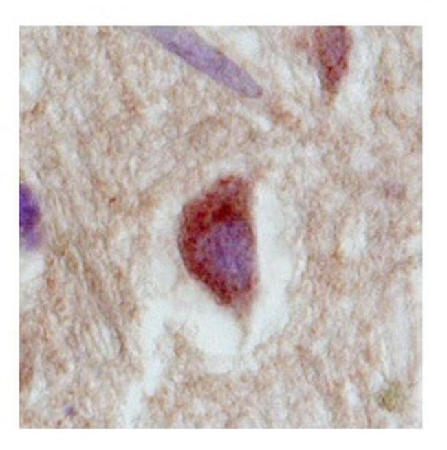 SLC18A1 Antibody in Immunohistochemistry (IHC)