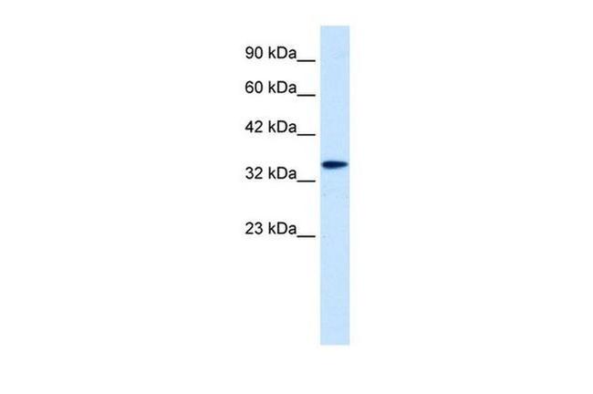 DLX6 Antibody in Western Blot (WB)