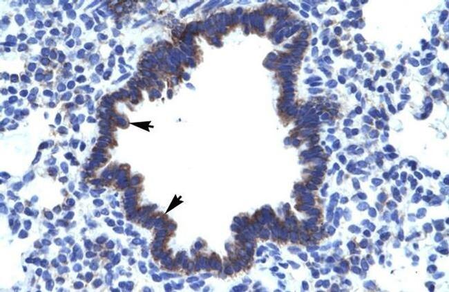 CHST4 Antibody in Immunohistochemistry (IHC)