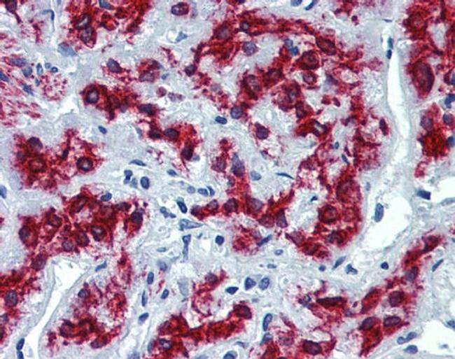 VEZF1 Antibody in Immunohistochemistry (Paraffin) (IHC (P))