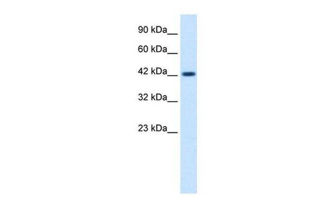 ZP3 Antibody in Western Blot (WB)