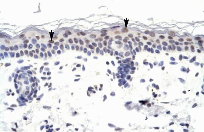 ZNF223 Antibody in Immunohistochemistry (IHC)