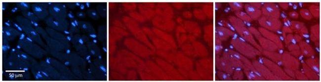 MLXIP Antibody in Immunohistochemistry (Paraffin) (IHC (P))