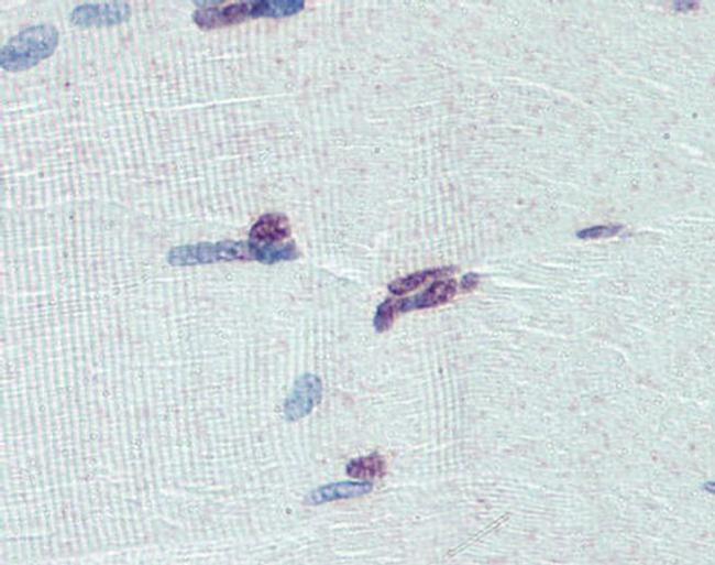 PRDM9 Antibody in Immunohistochemistry (Paraffin) (IHC (P))