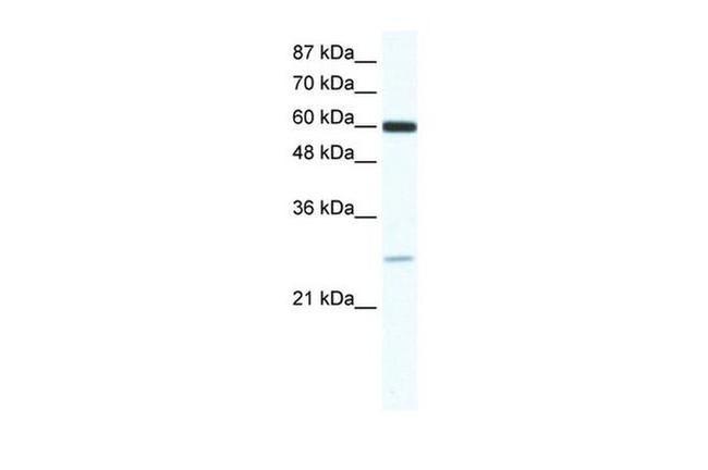 ZFP91 Antibody in Western Blot (WB)