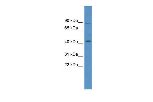 ZNF540 Antibody in Western Blot (WB)