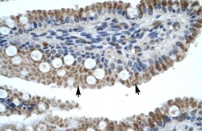 ZNF683 Antibody in Immunohistochemistry (IHC)