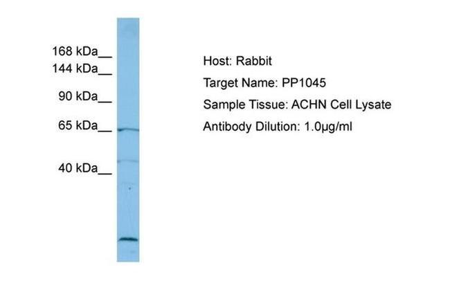 RECQL5 Antibody in Western Blot (WB)