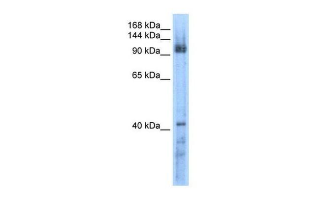 RECQL5 Antibody in Western Blot (WB)