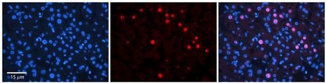 RAD54B Antibody in Immunohistochemistry (Paraffin) (IHC (P))