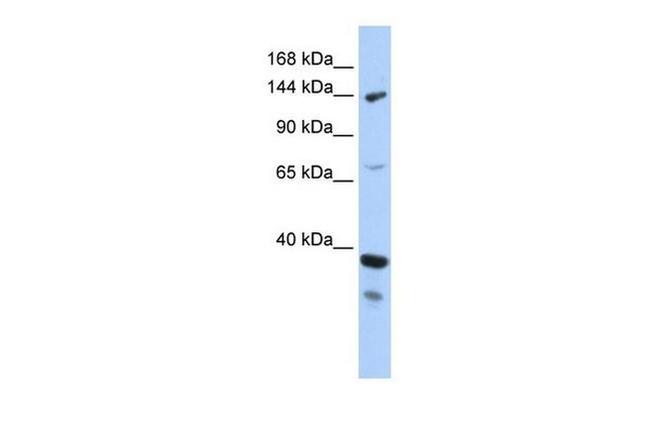 DHX37 Antibody in Western Blot (WB)